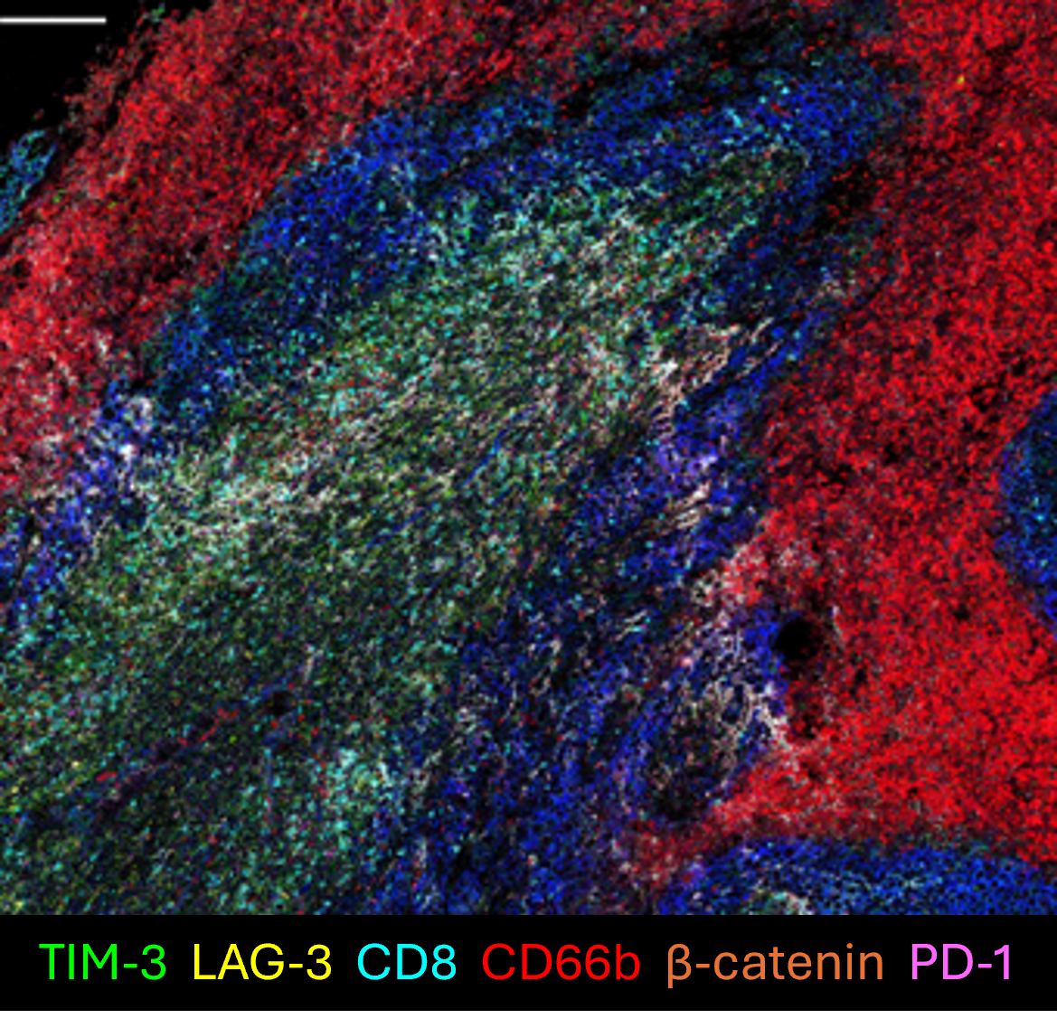 T Cell Exhaustion